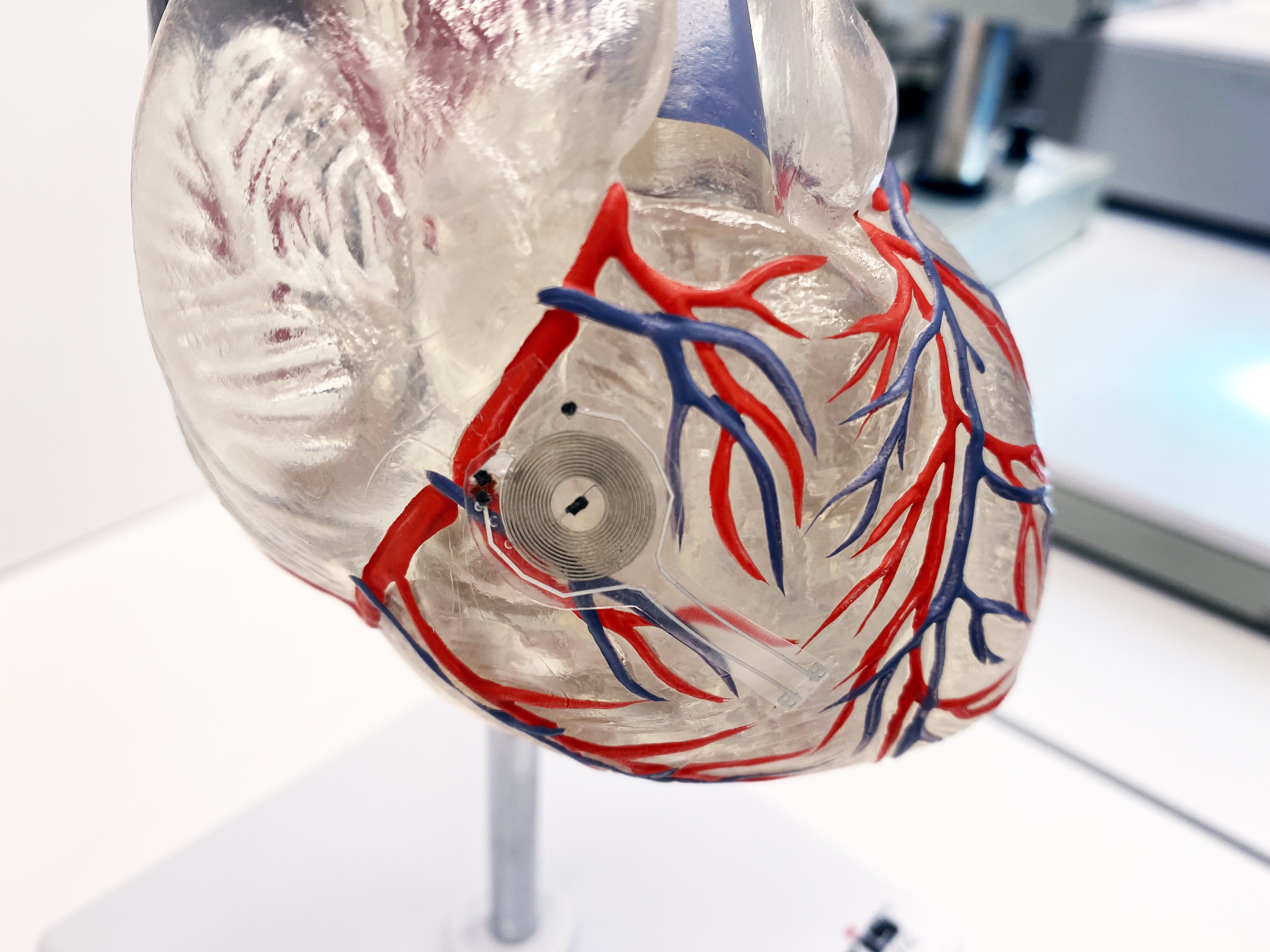 Dissolving Pacemaker