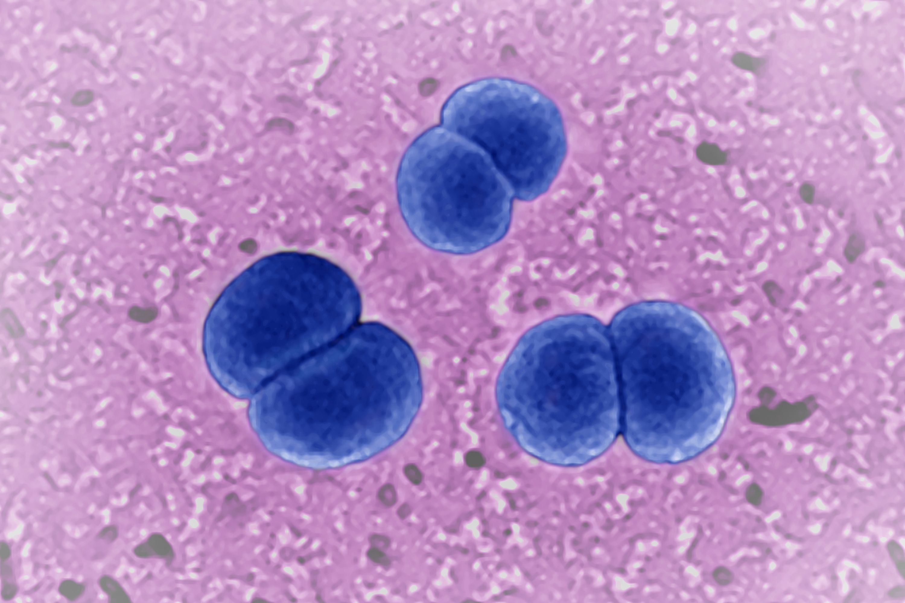 Neisseria meningitidis