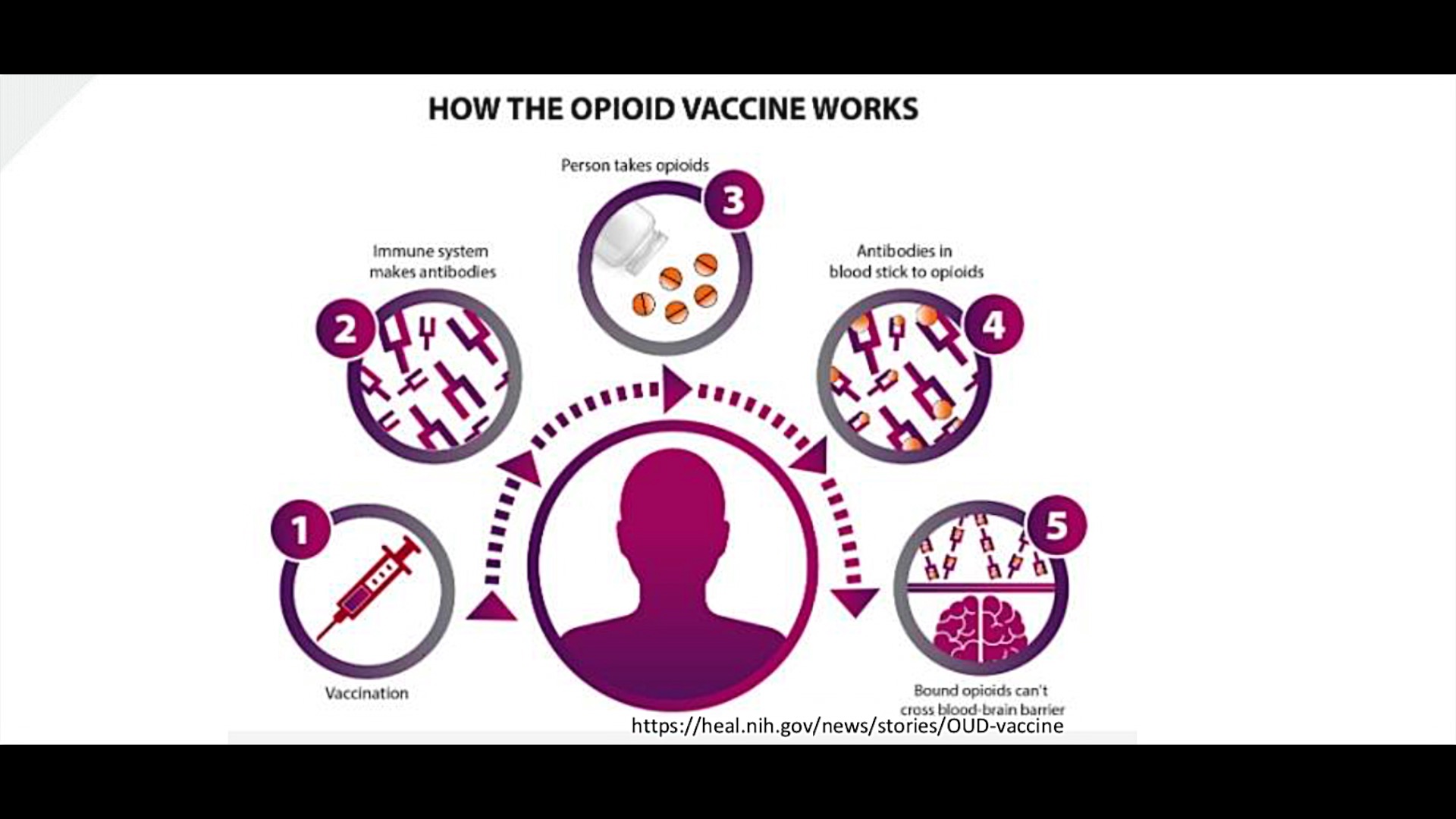 UMOpioidVax1.jpg