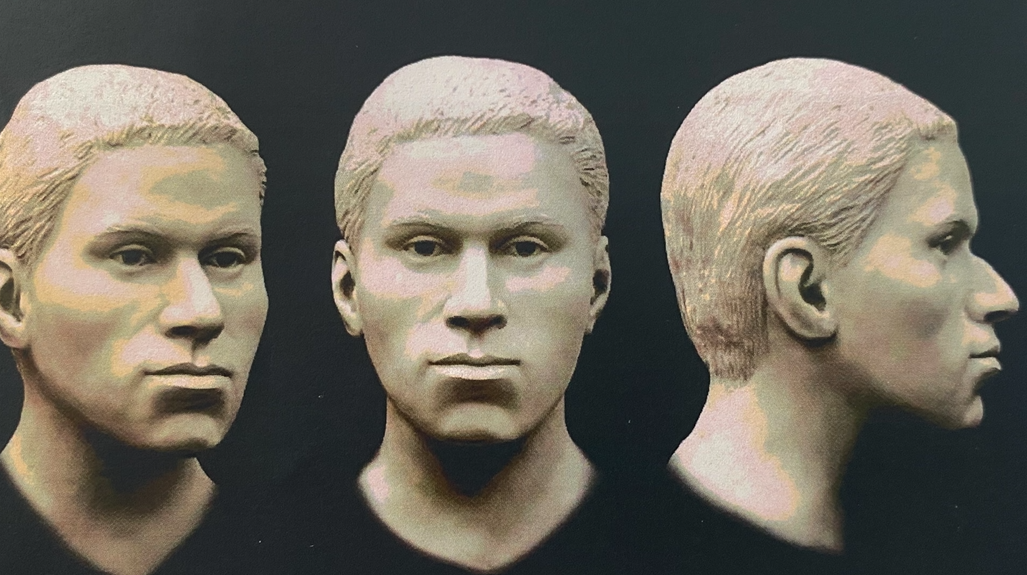 Facial Approximation