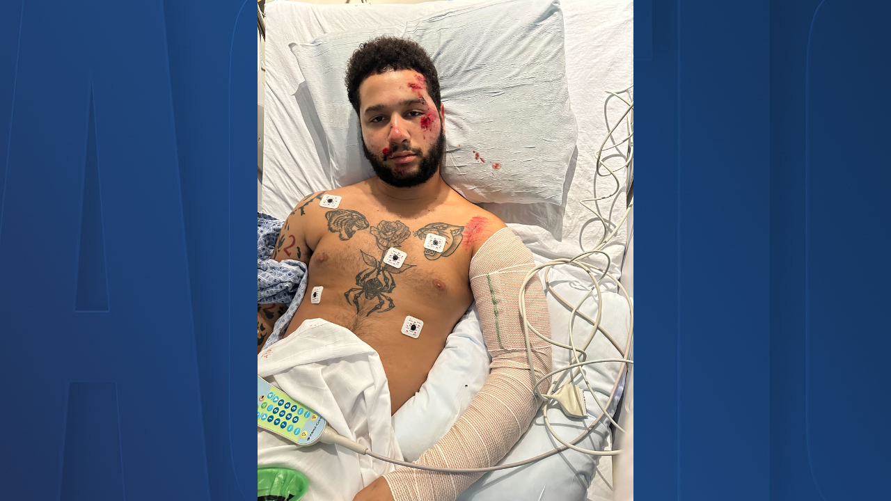 hit and run victim.png