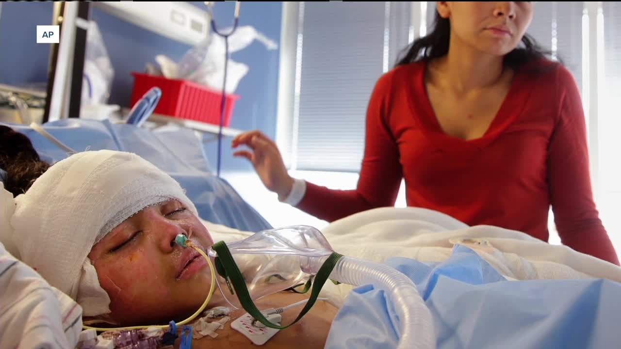 Avoiding serious burns