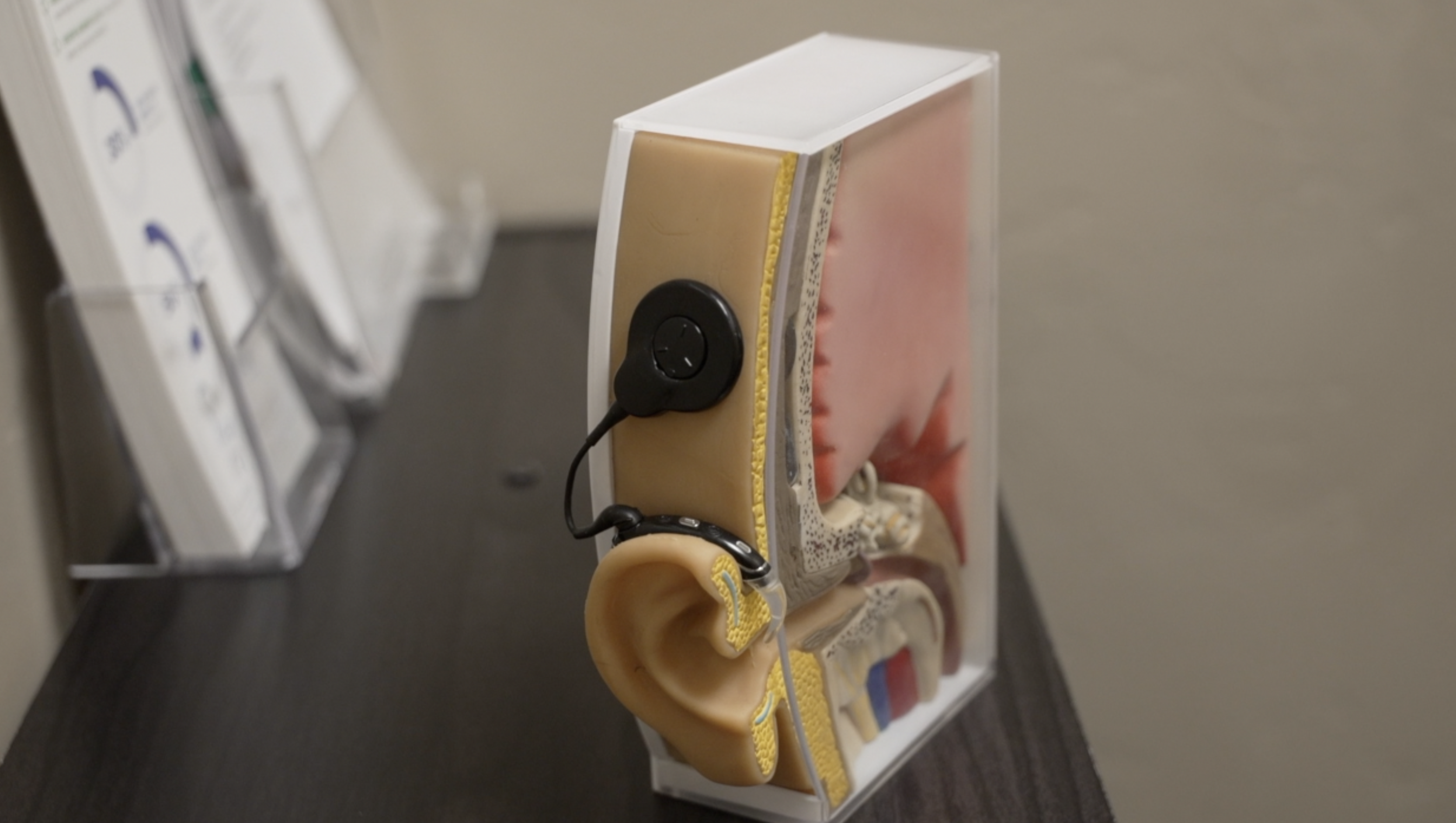 External Cochlear Implant
