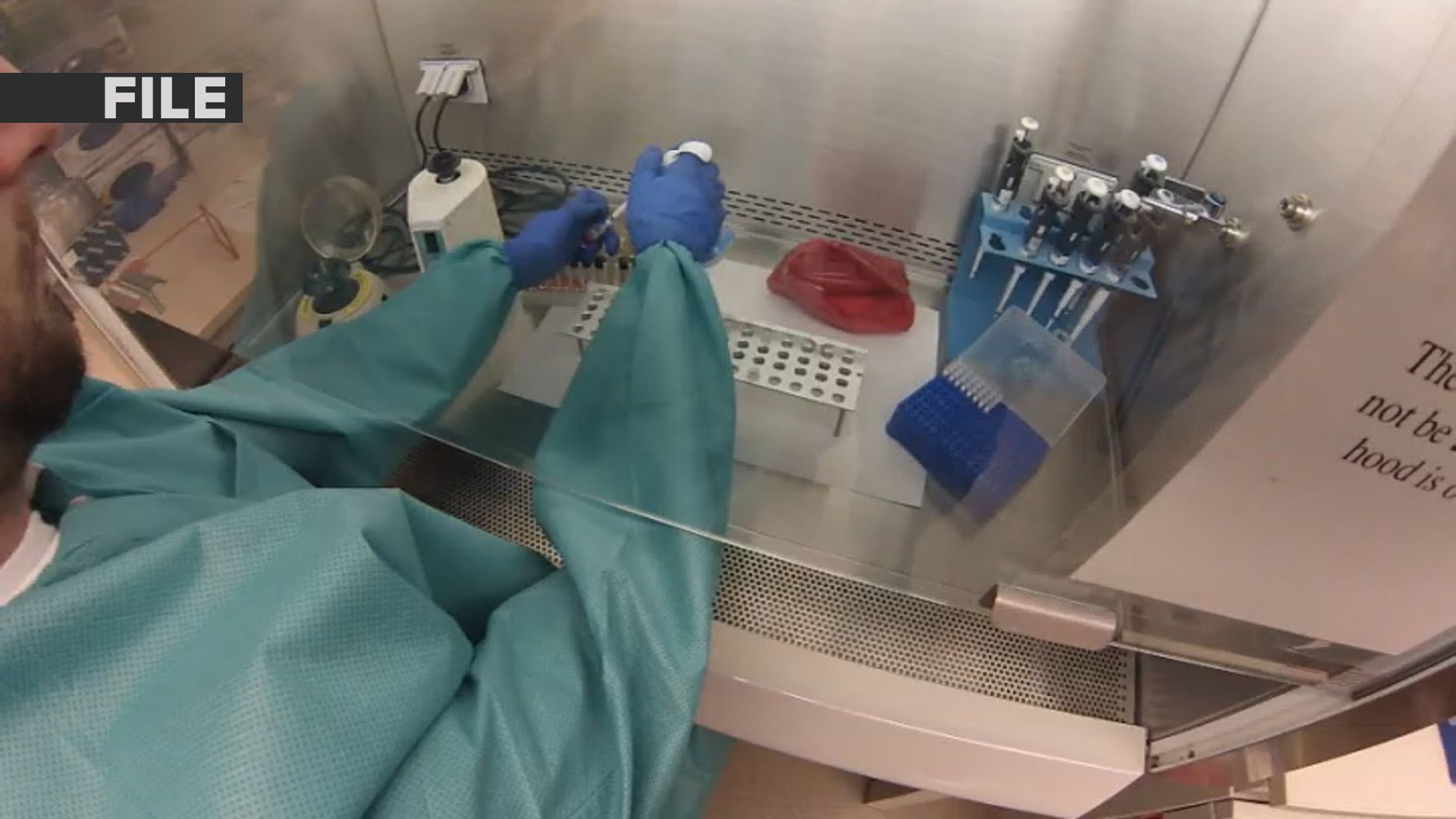 Pediatric inflammatory illness linked to coronavirus