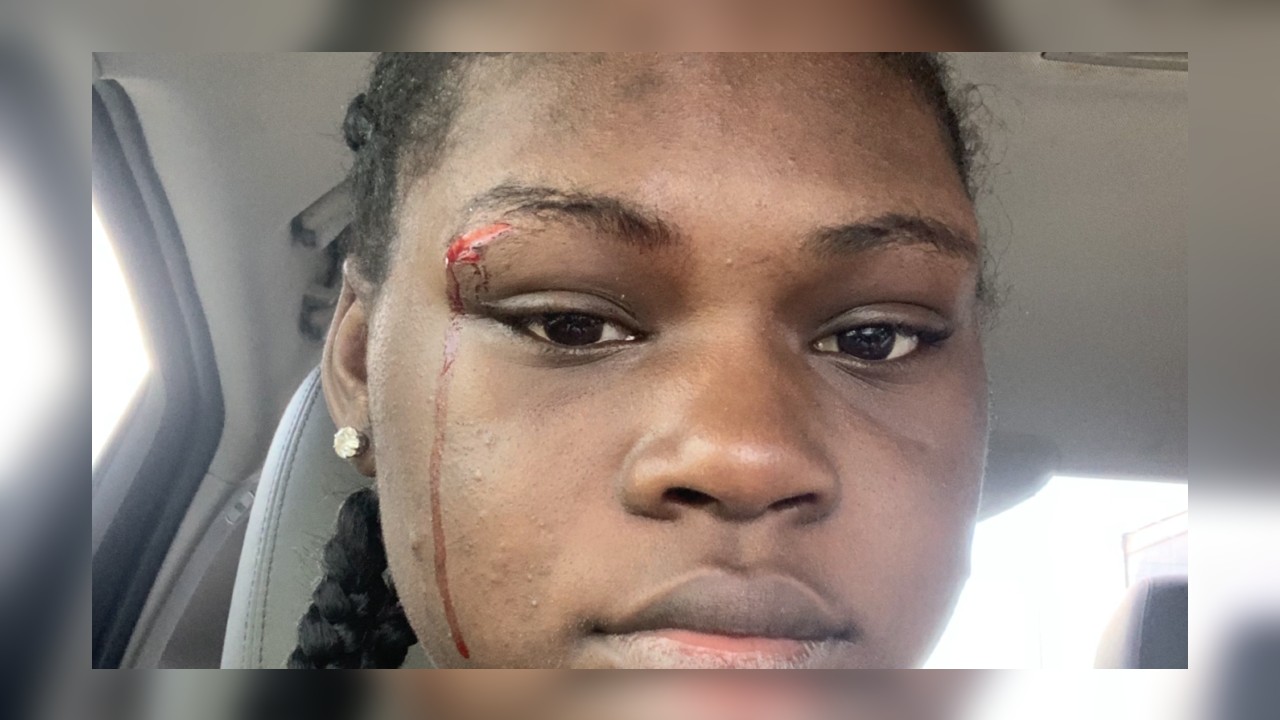 Teenage hostess at Chili's in Louisiana reportedly attacked for enforcing COVID-19 guidelines