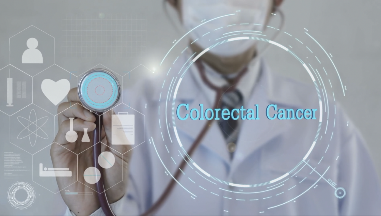 colorectal cancer
