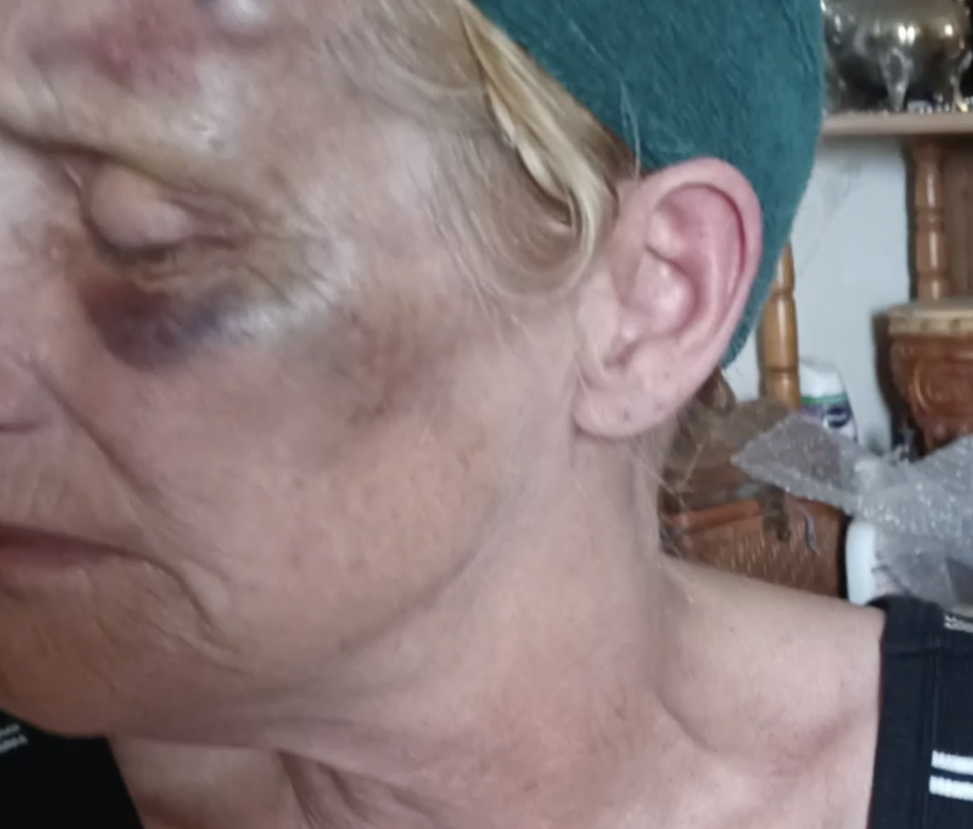 Imperial Beach grandmother punched in road rage attack