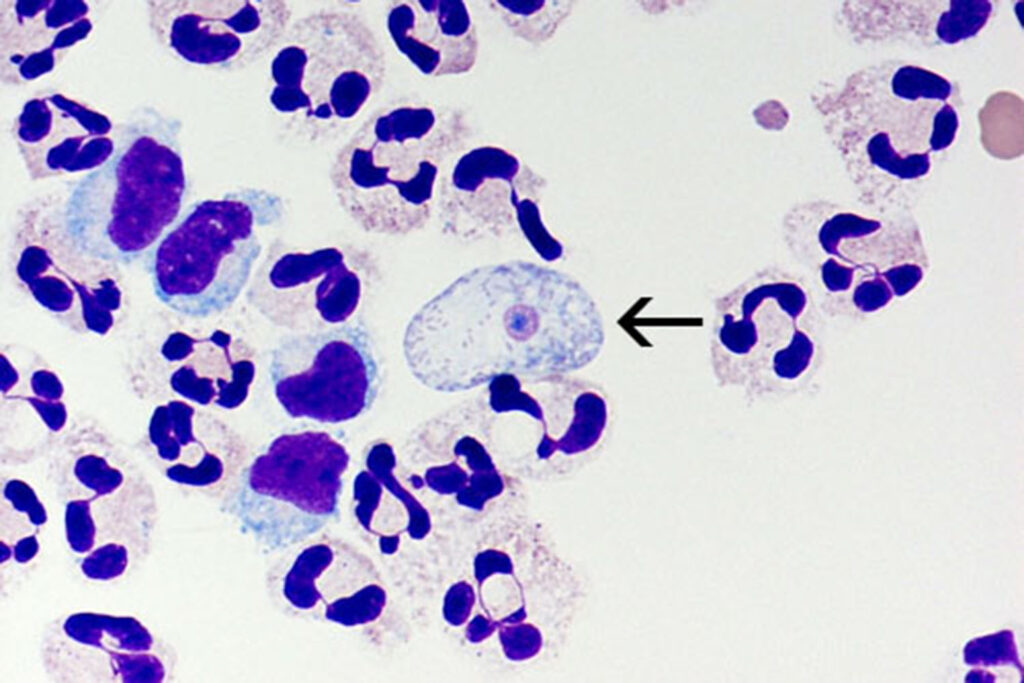 naegleria fowleri cells