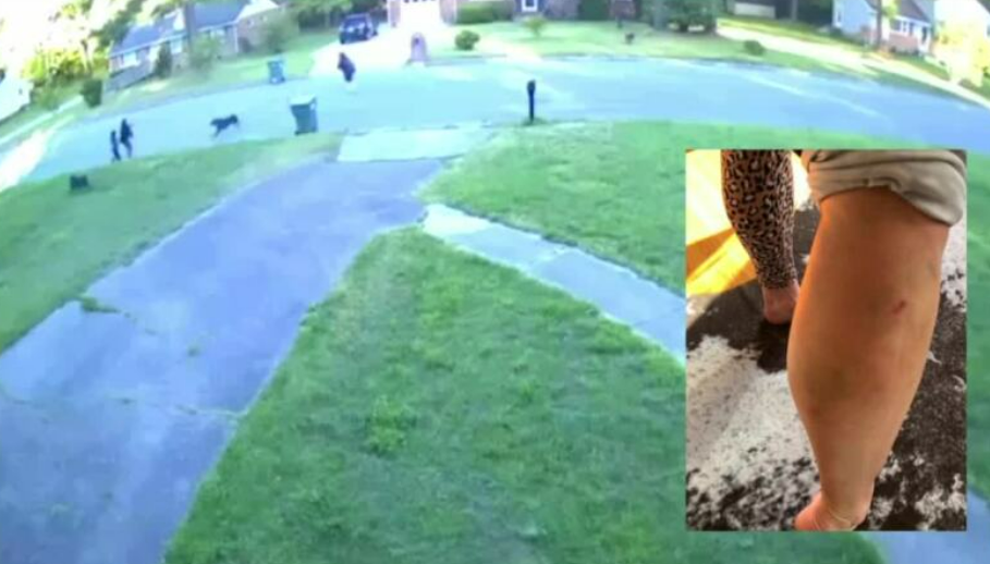 A young Henrico boy was attacked by dogs. Another woman claims she was too.