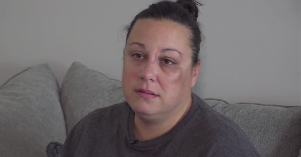 Domestic violence survivor