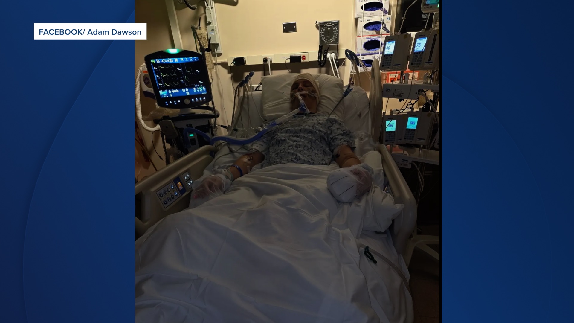 DoorDash driver hospitalized