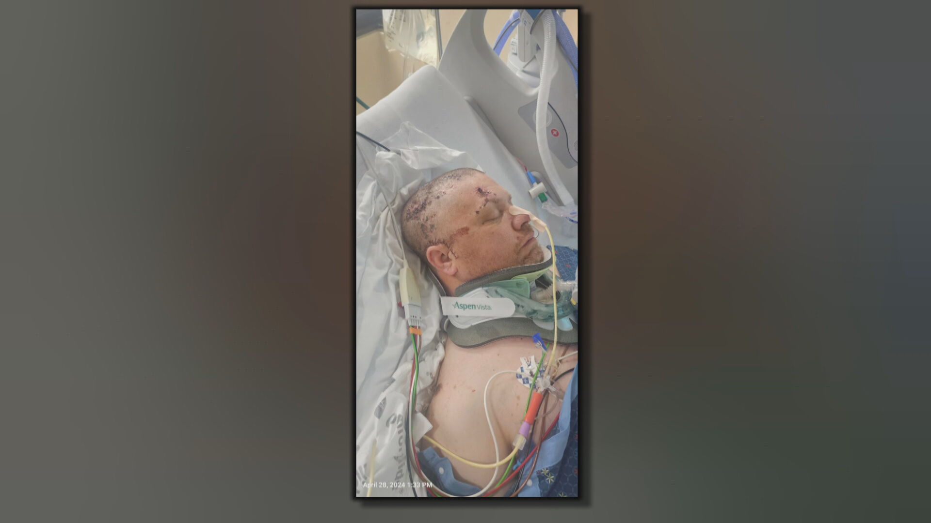 Bryan Eidel brain injury