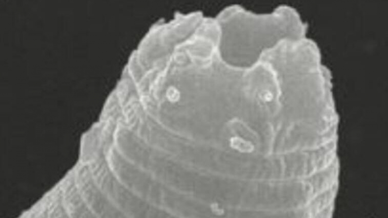 Microscope image of a worm that was brought back to life.