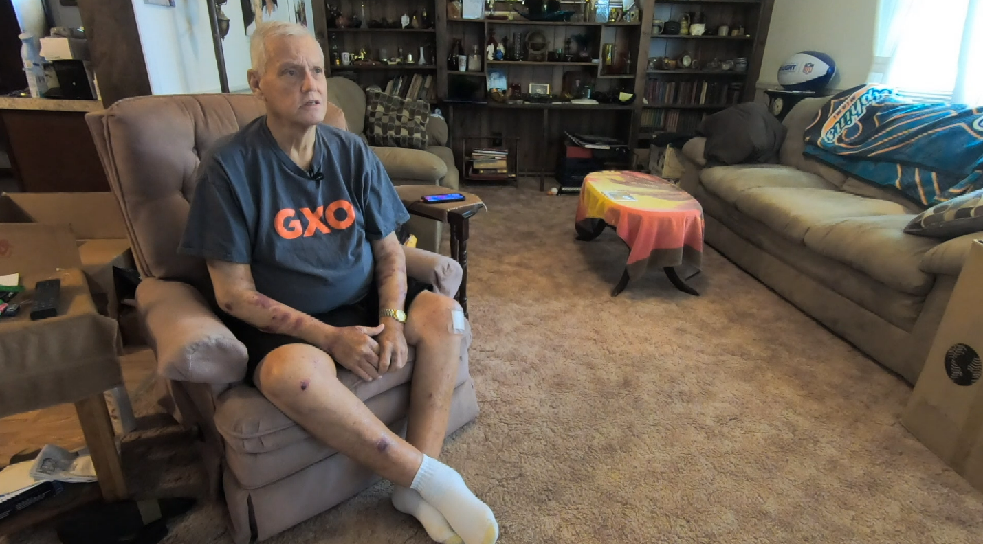 In desperate need of a liver transplant, this man fears he won't wake up when he goes to sleep