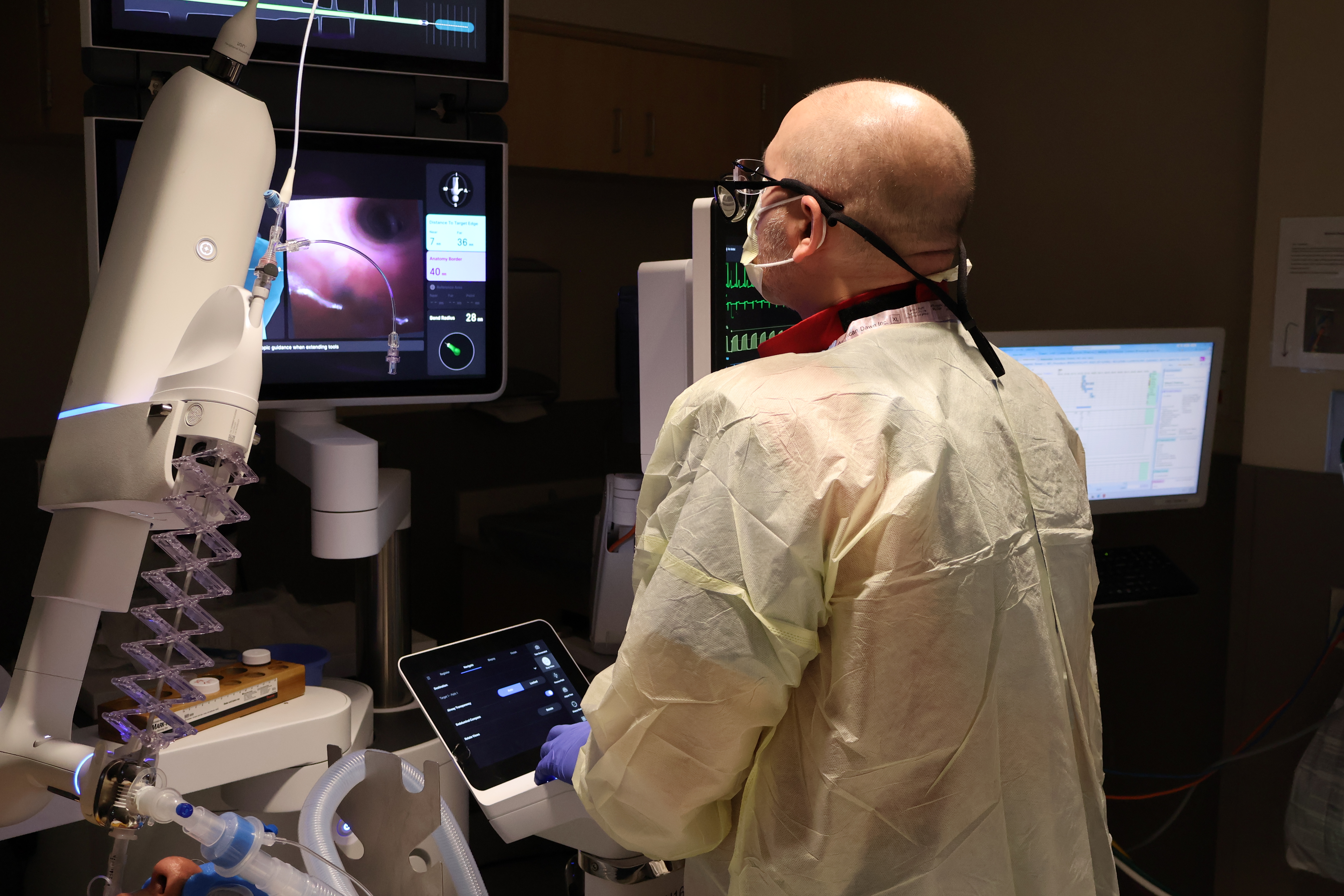 Ion robotic bronchoscopy 