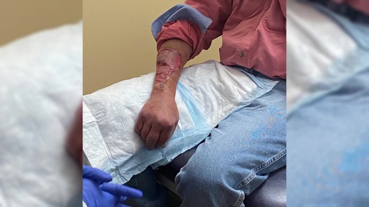 arm injury.jpg