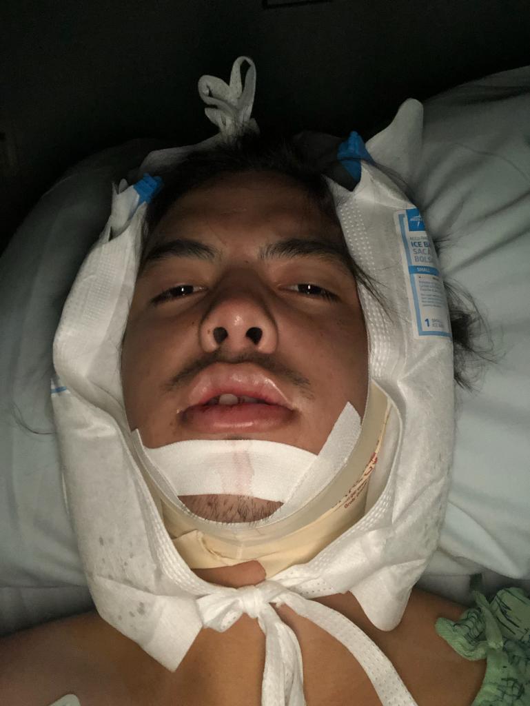 Ocean Beach attack victim