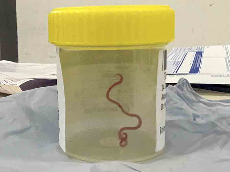 Australia Brain Parasite