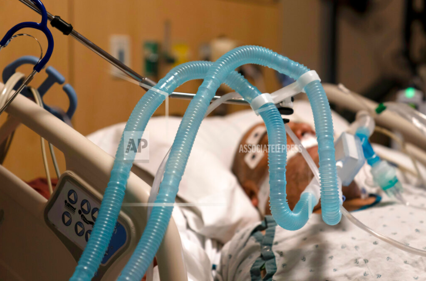 Ventilator tubes file photo