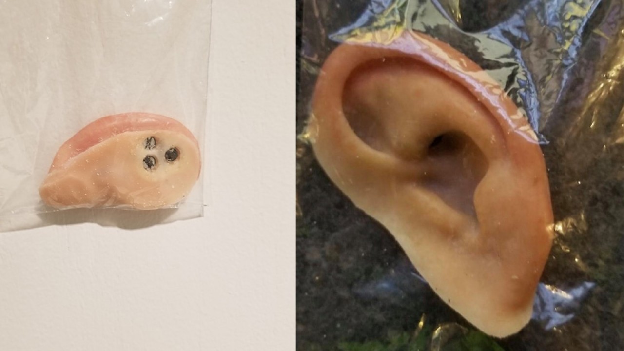 wfts-prosthetic-ear.jpeg