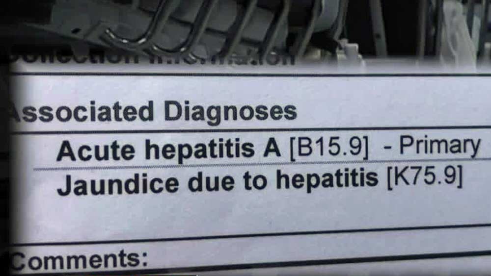 Acute hepatitis A