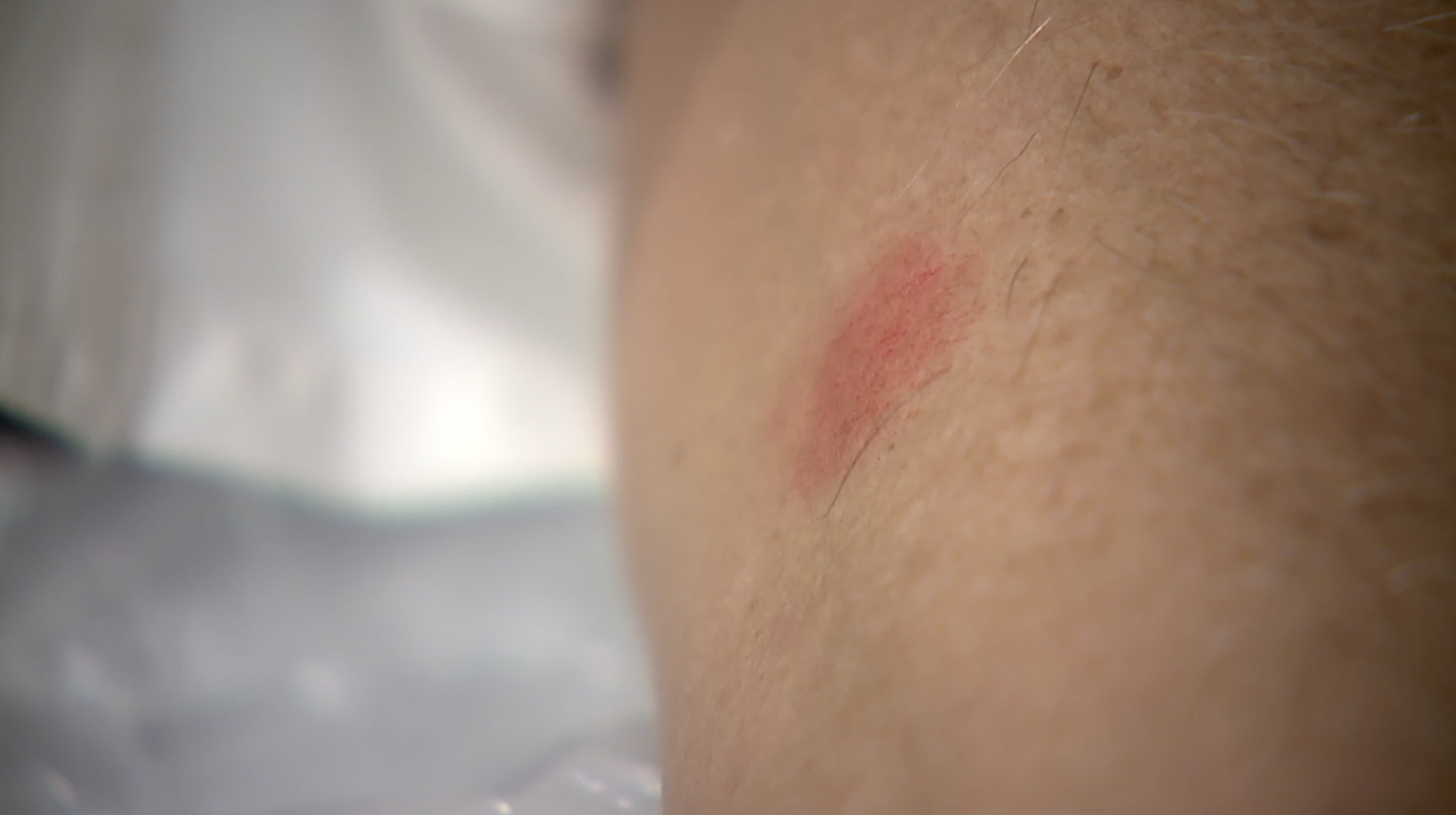 Diomics test monitors for COVID-19 antibodies