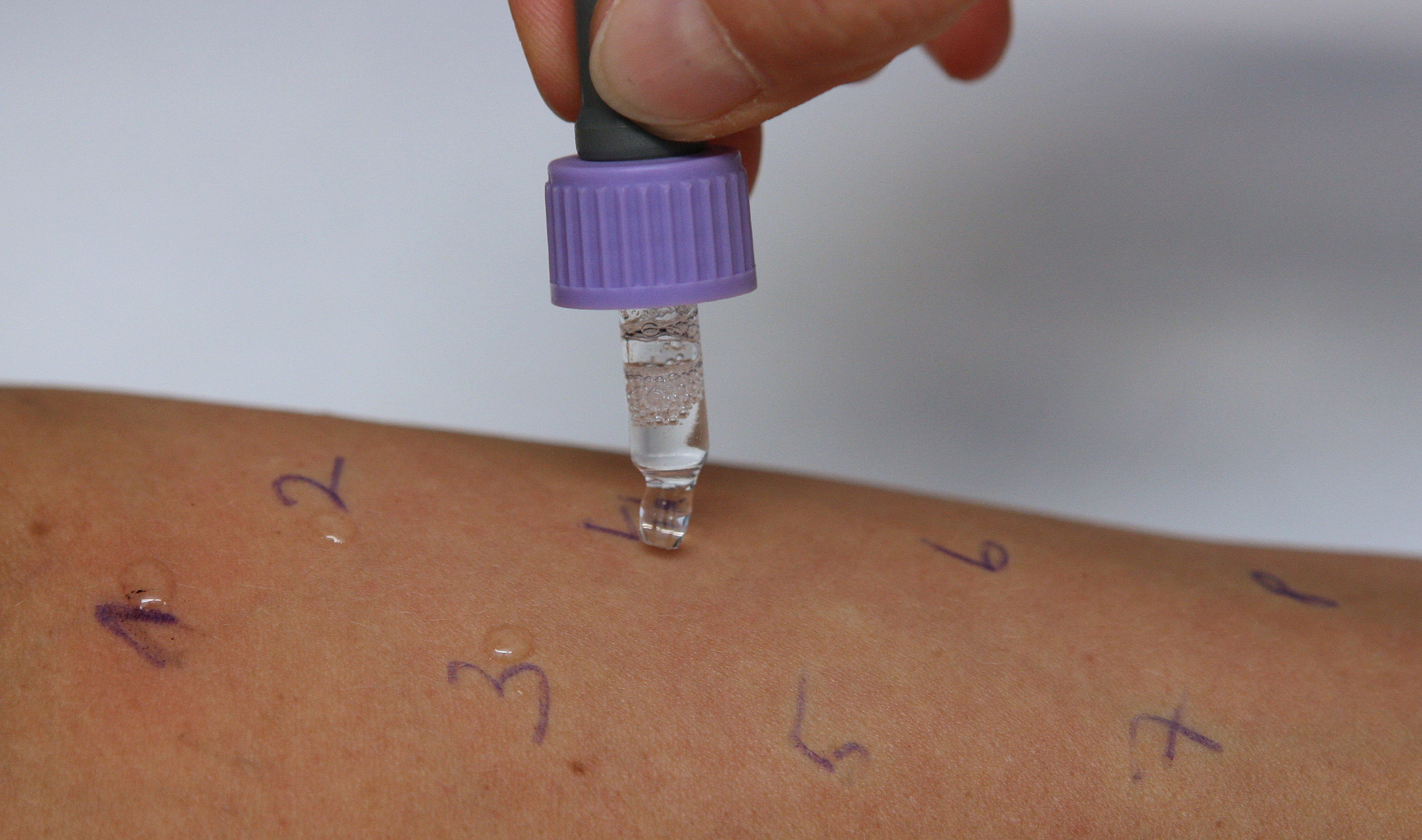 GS Gesundheit Pollenallergie