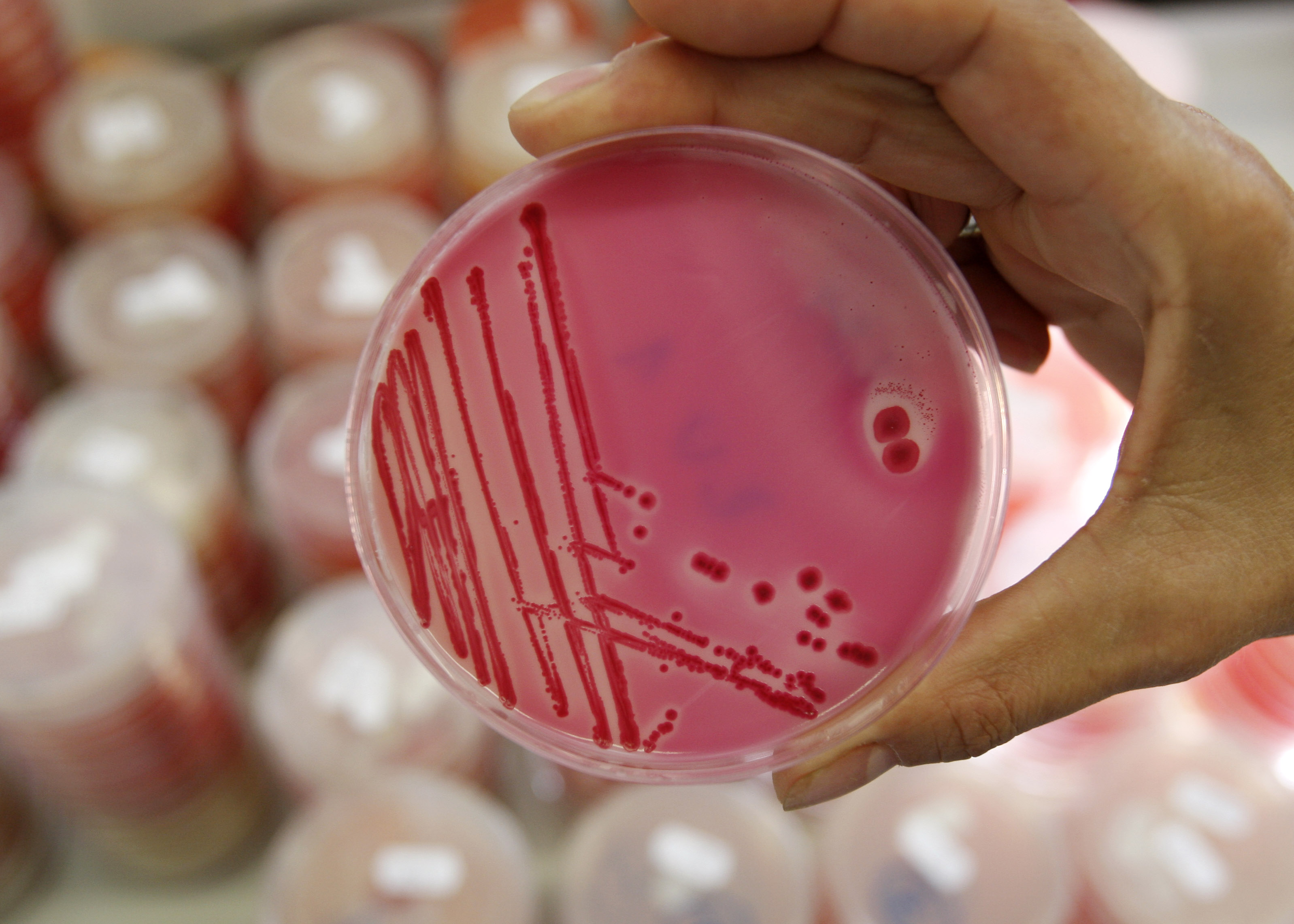 salmonella culture_generic.jpg