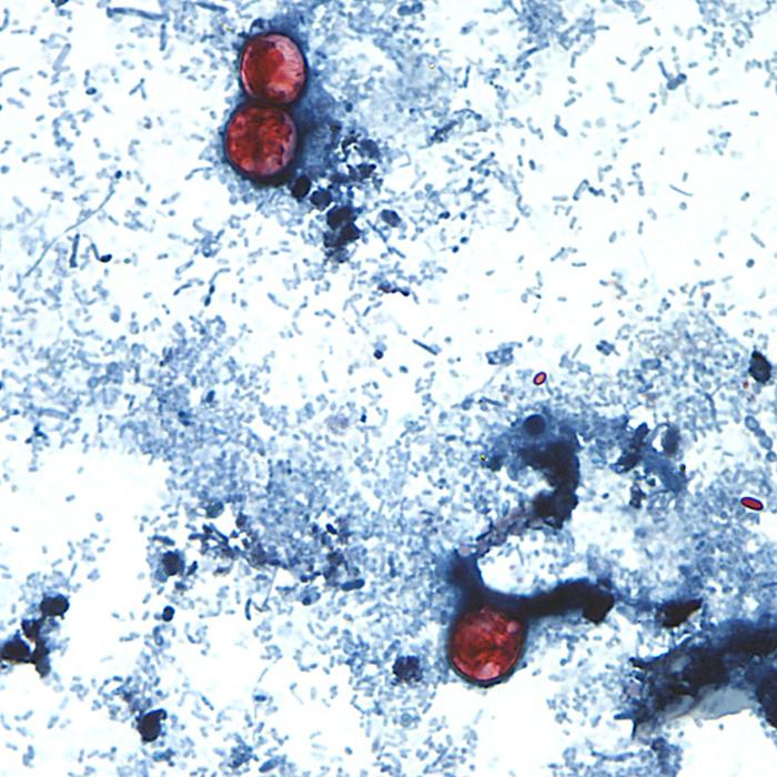 cyclospora.jpg