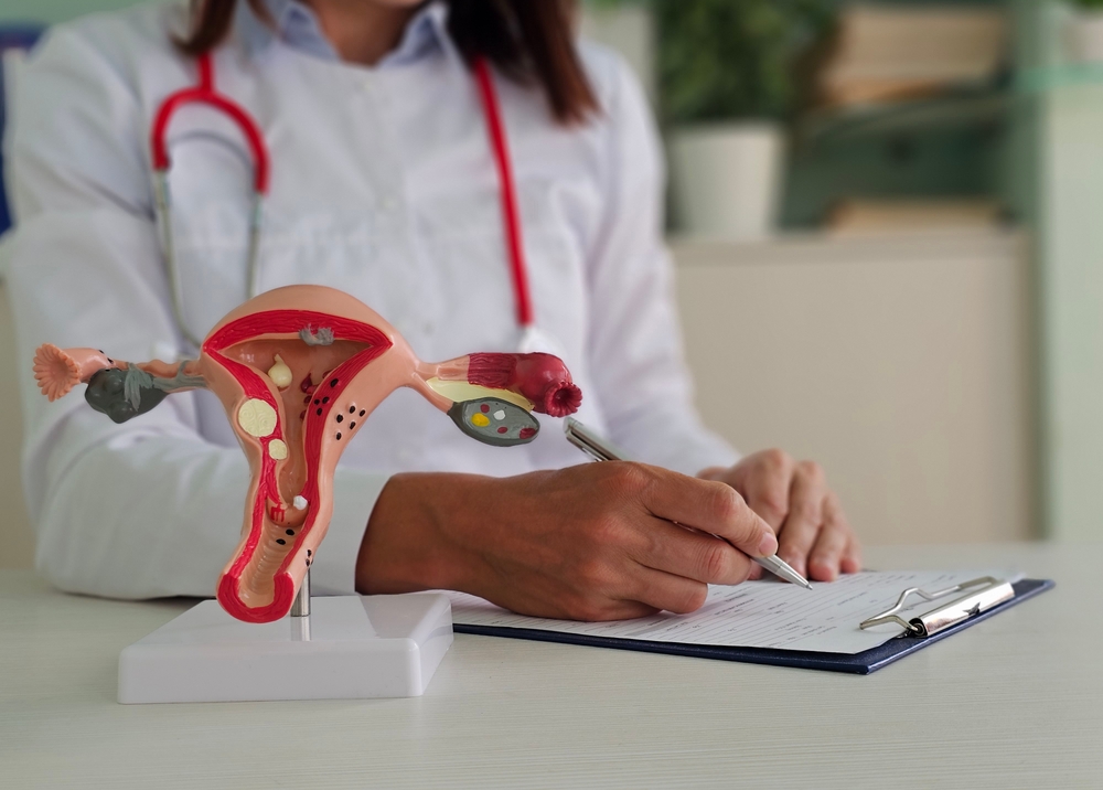 Gynecologist consults woman with a model of a uterus. 