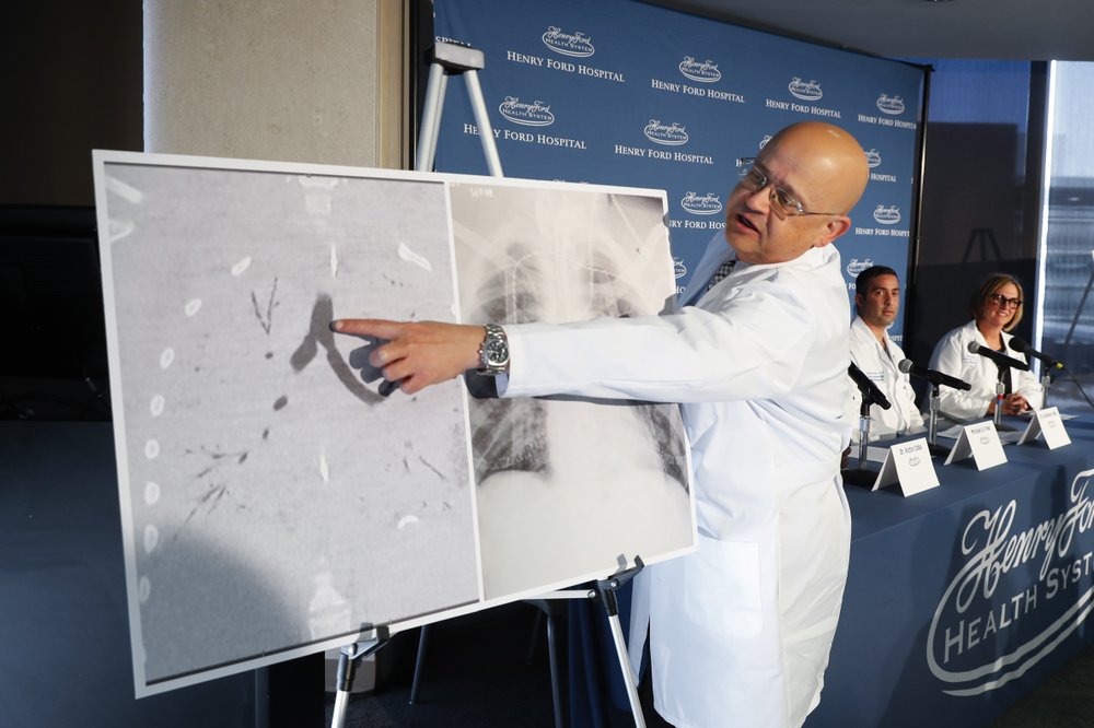 lungtransplant.jpeg