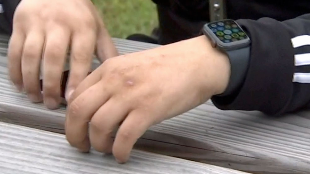 WPTV-apple-watch-saves-hiker-.jpg