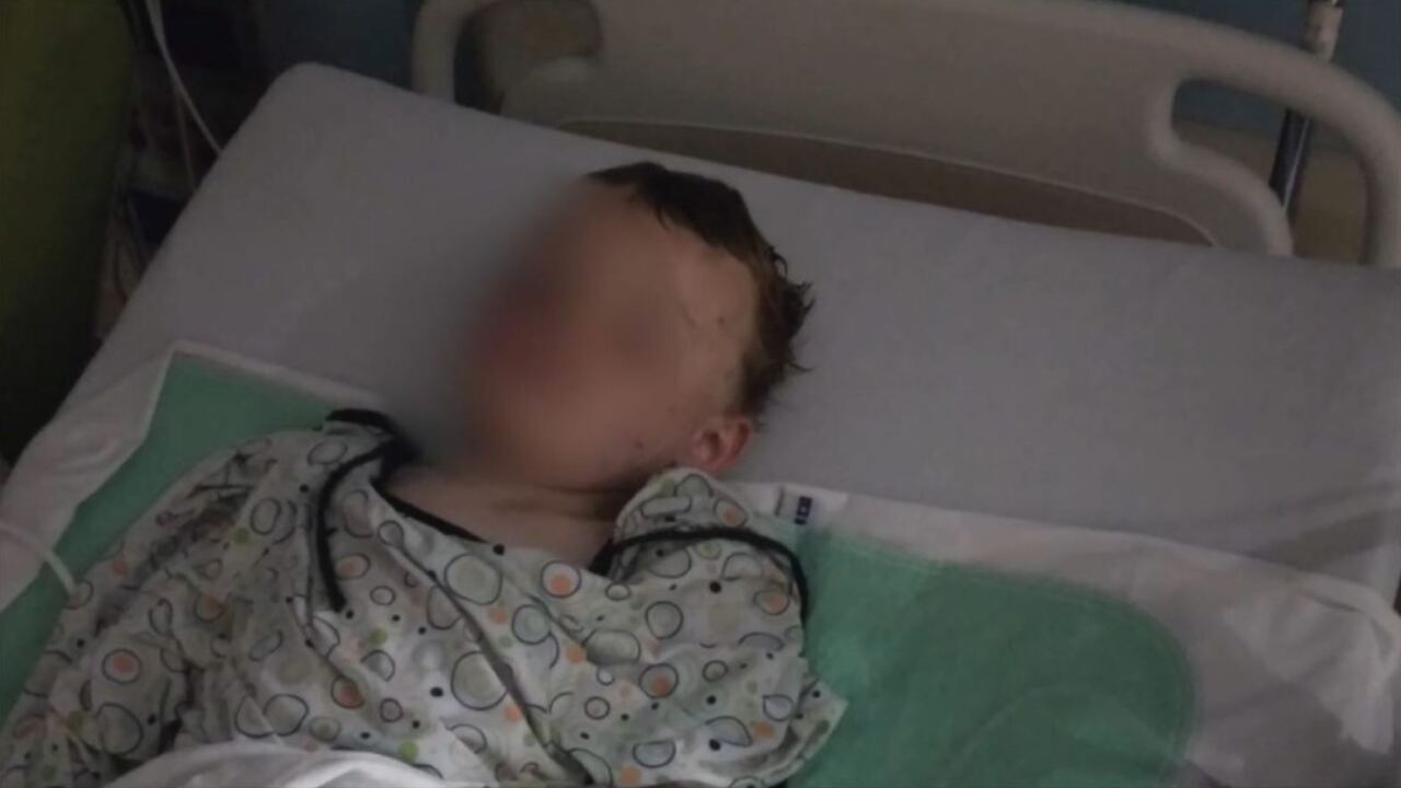 Montcalm County boy injured in dog attack
