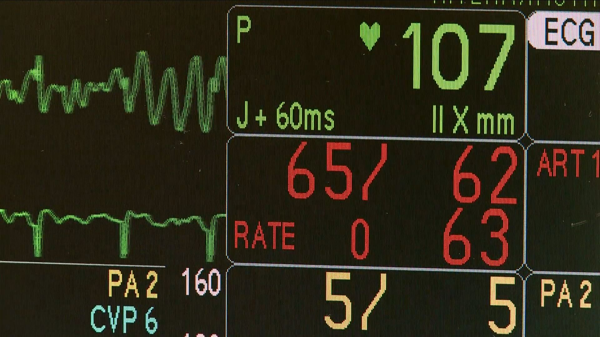 Watching out for your heart health during winter months