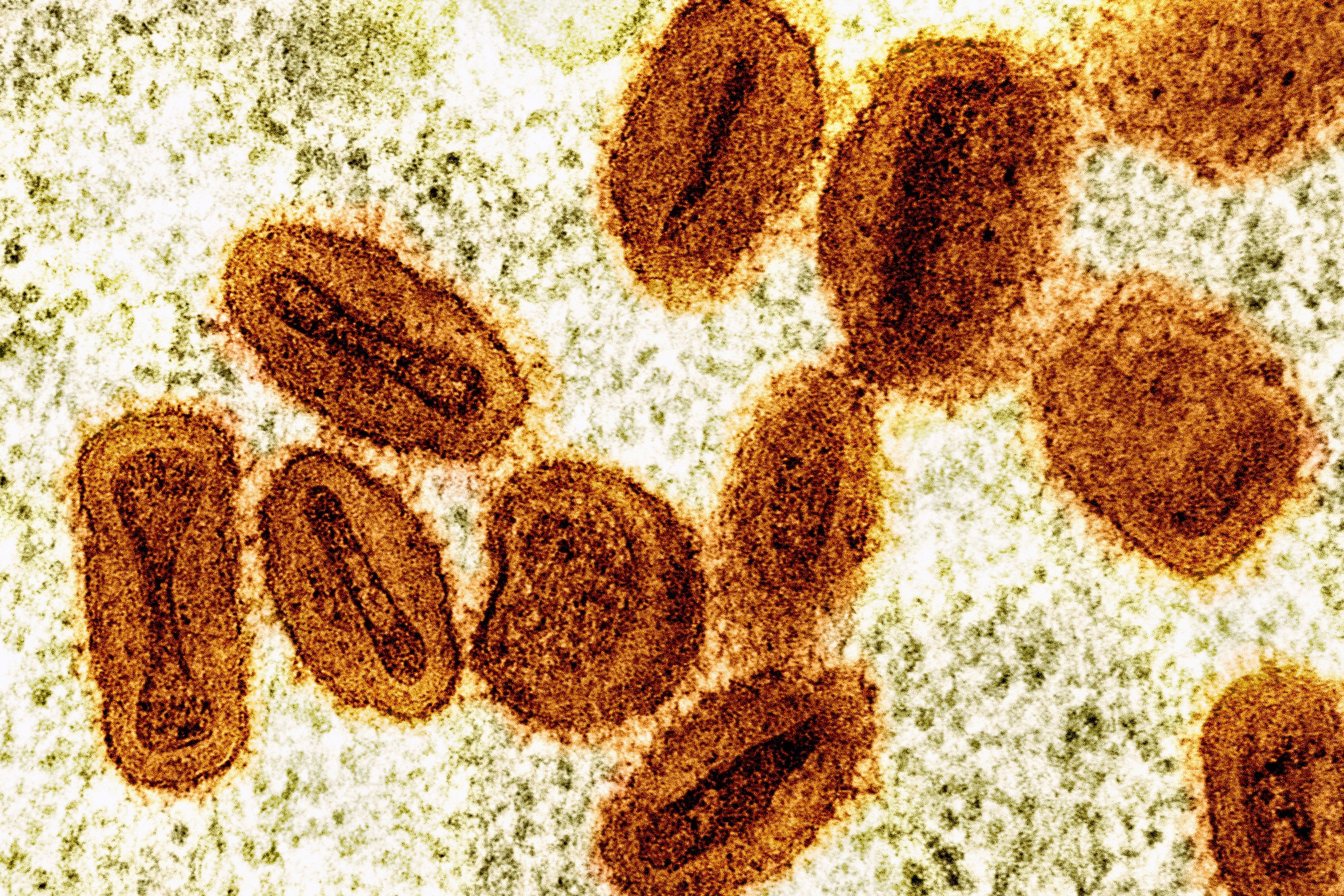 Scientists Charged Mpox