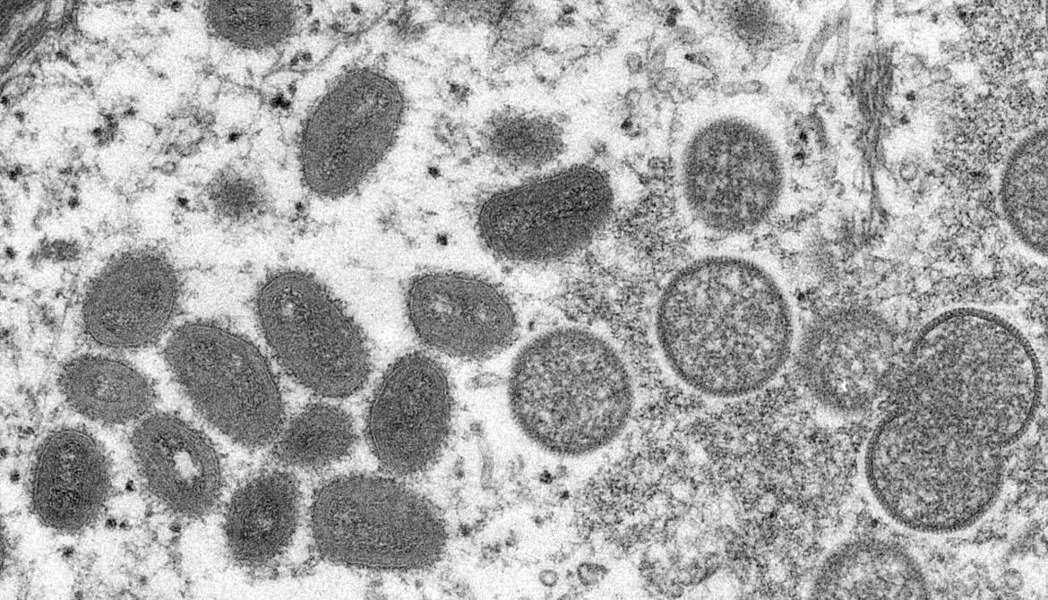 Mpox virus