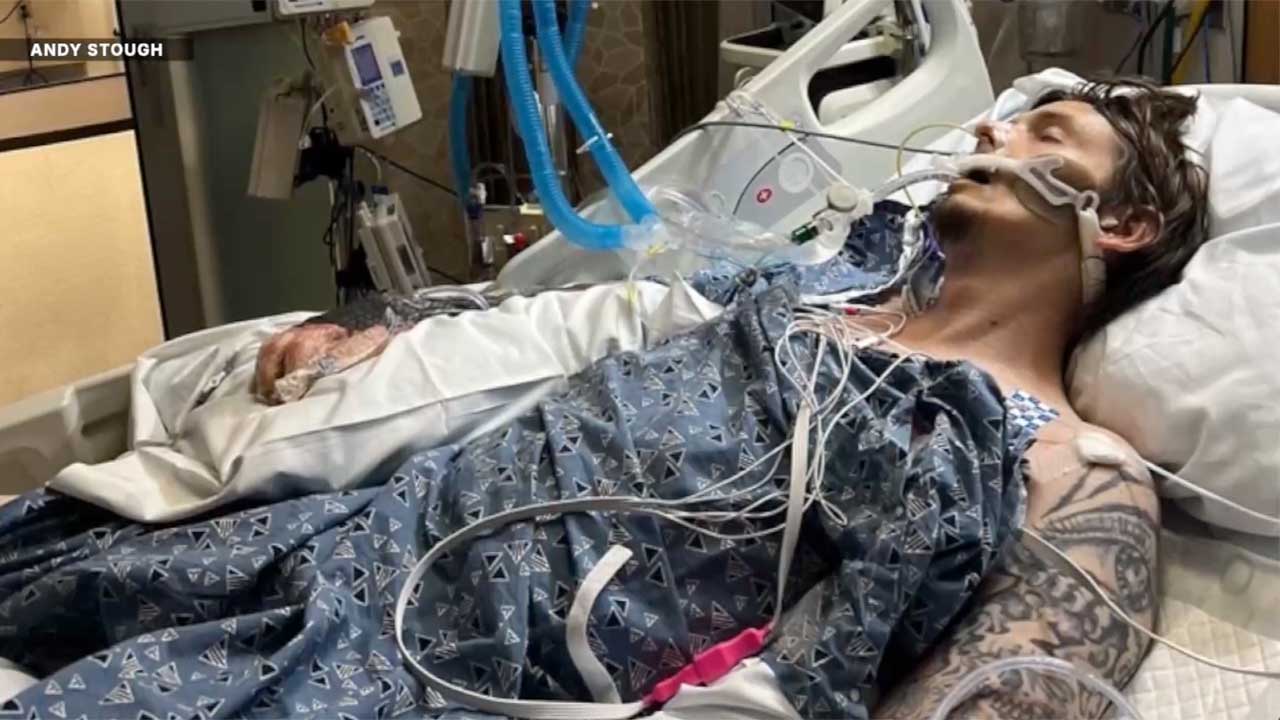 Andy Stough of Boynton Beach is sharing his survival story after a flesh-eating bacterial infection left him hospitalized for 101 days.