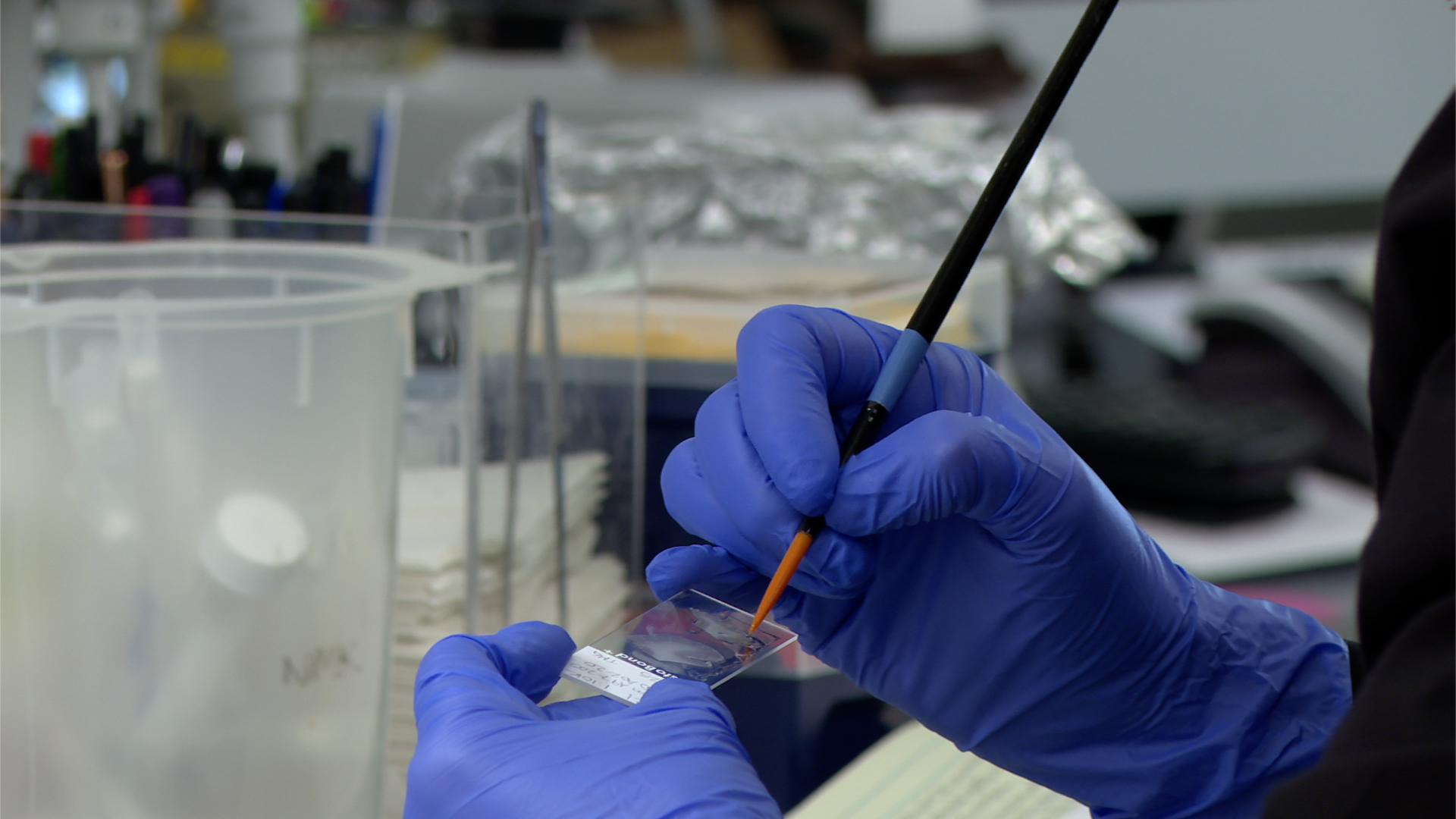 Trump administration's proposed funding cuts raise concerns for NIH and universities