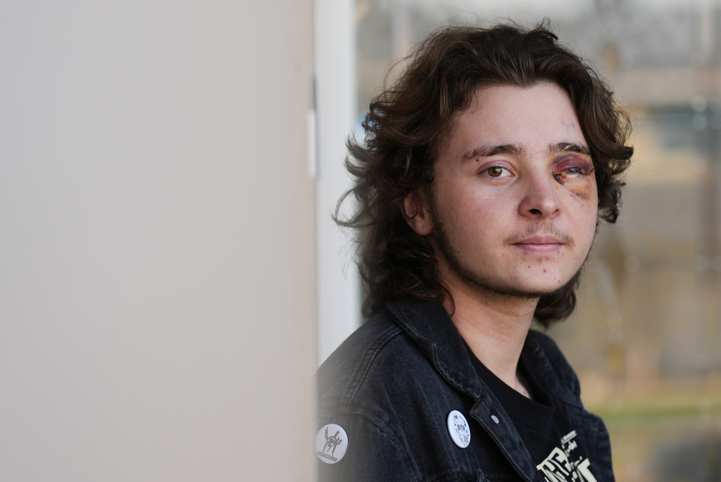 Kaden Rummler, who was injured after being hit with a projectile fired by a federal agent during a protest outside an immigration building in Santa Ana, Calif., poses for a portrait Wednesday, Jan. 14, 2026, in Southern California. 