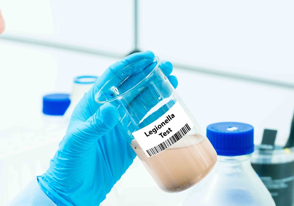 Legionella Test Measures the presence of Legionella bacteria in water.