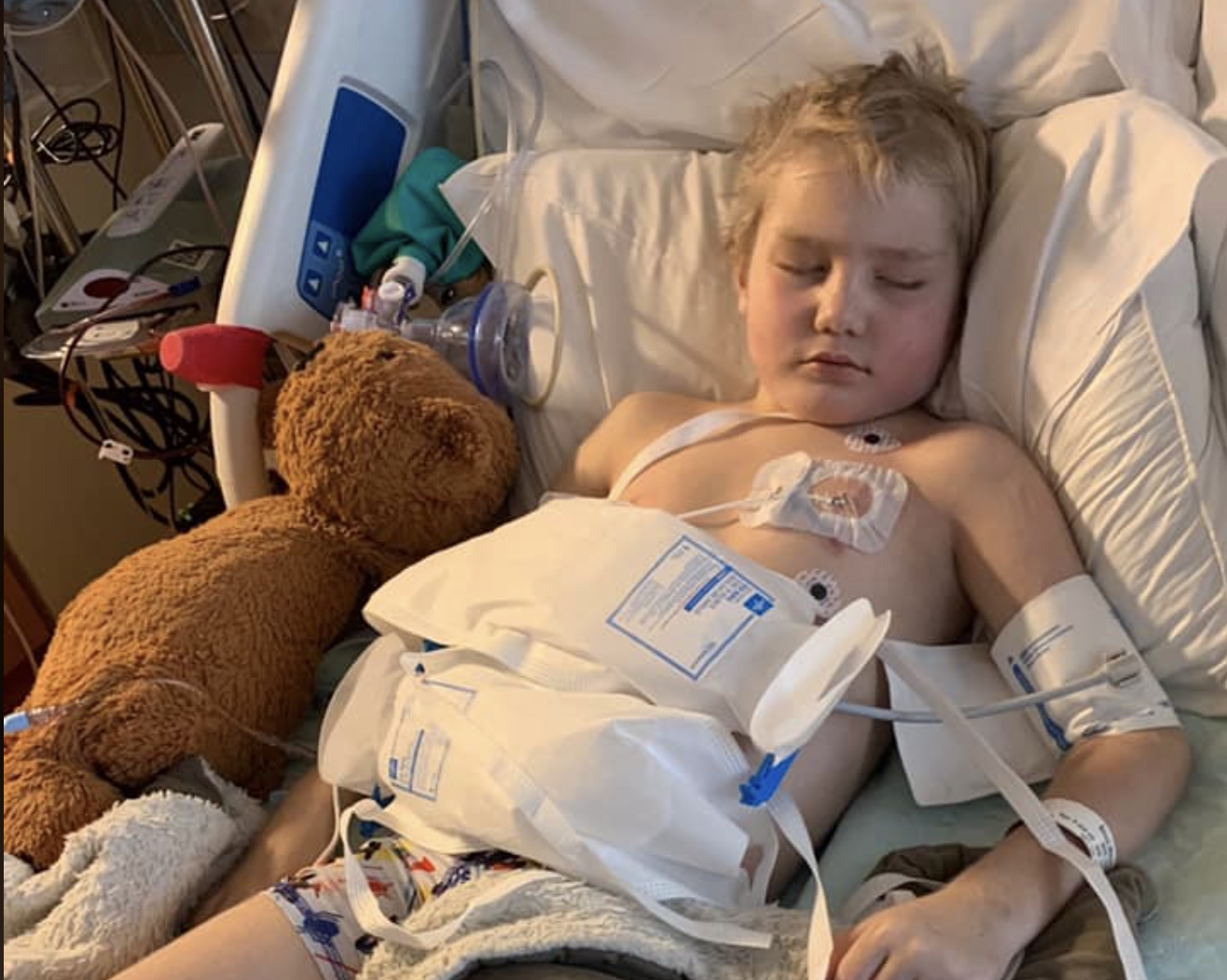 Flathead community rallies behind Kila boy in critical care