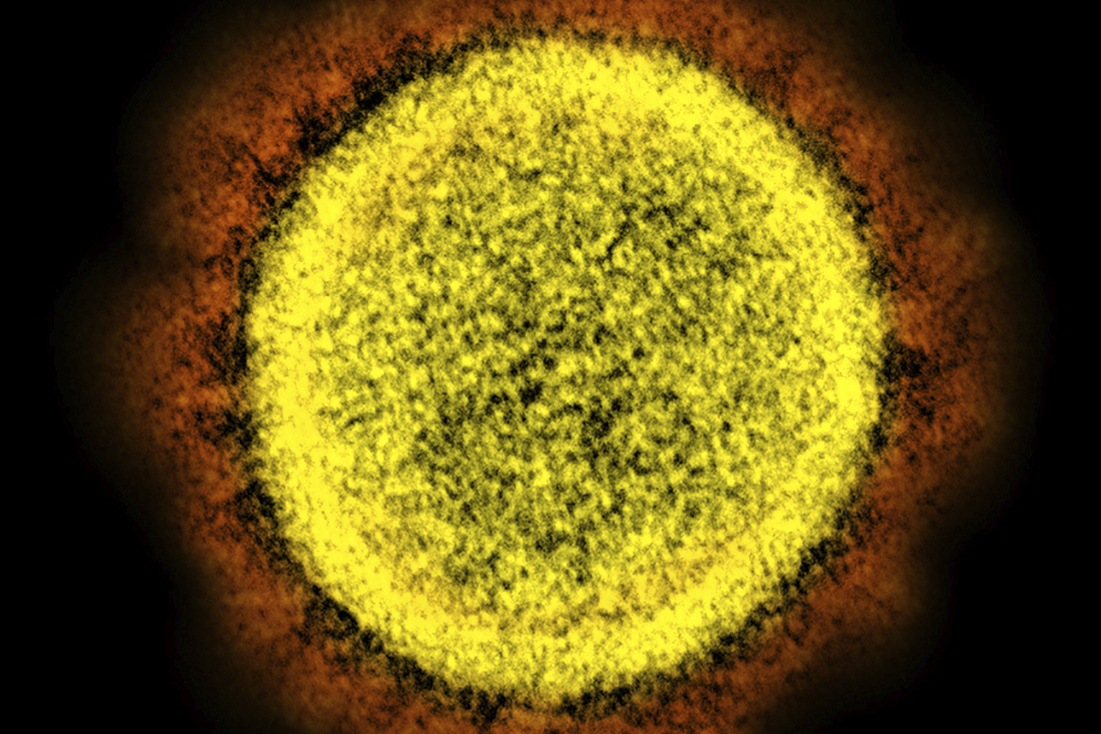 Virus Outbreak Obesity