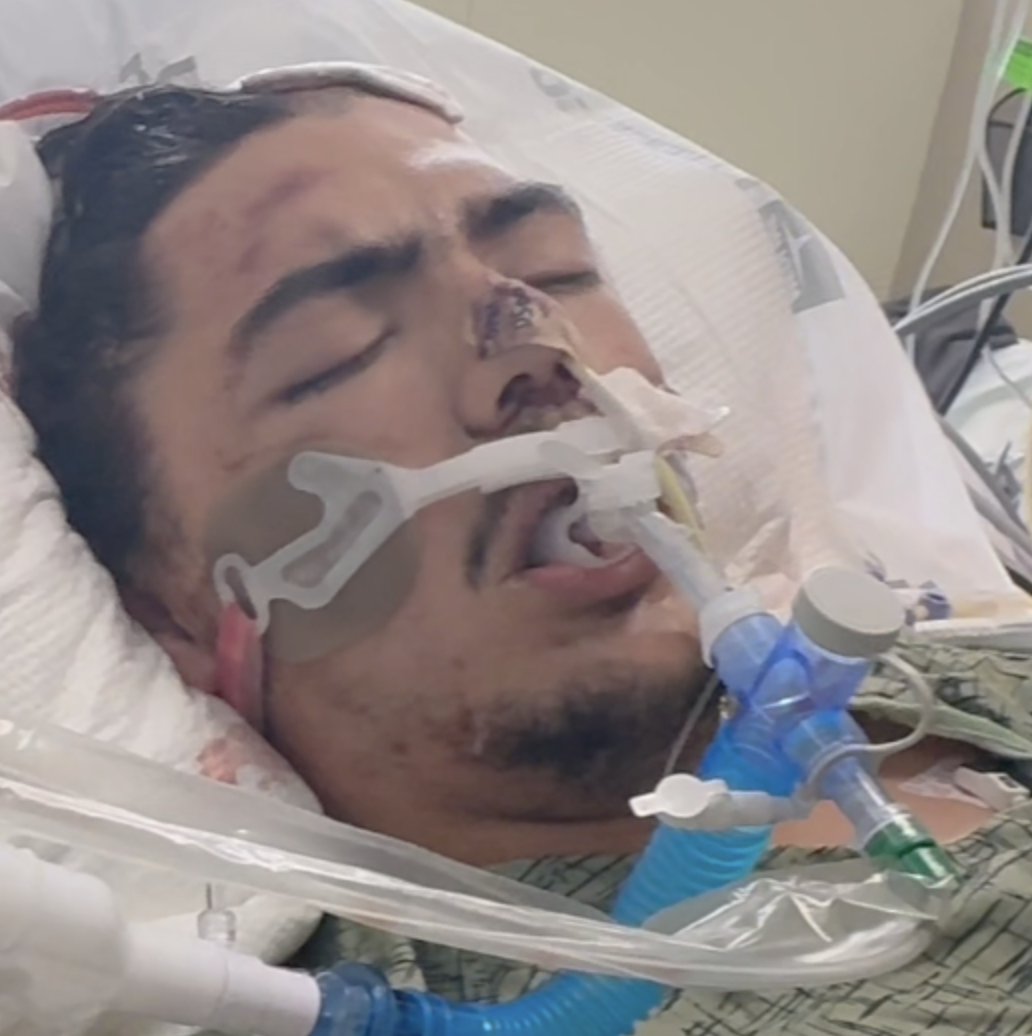 Lakeside man makes 'miracle' recovery after motorcycle crash