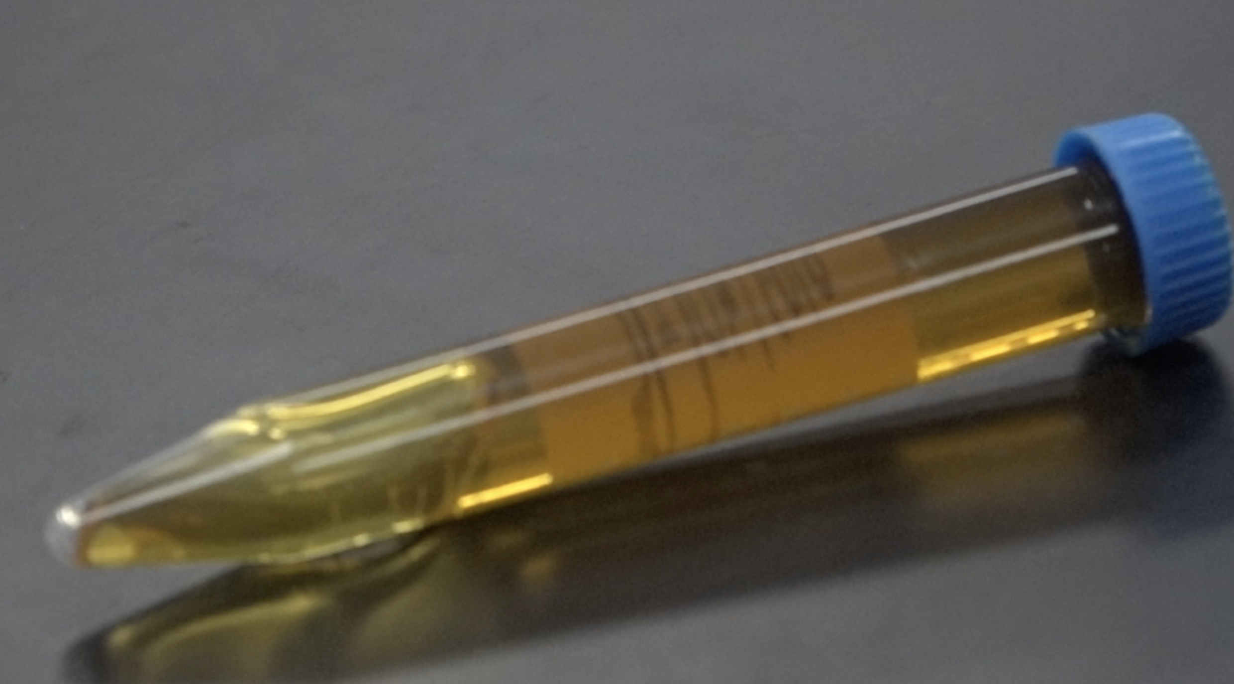 San Diego lab warns of 'concerning' pesticide levels in cannabis