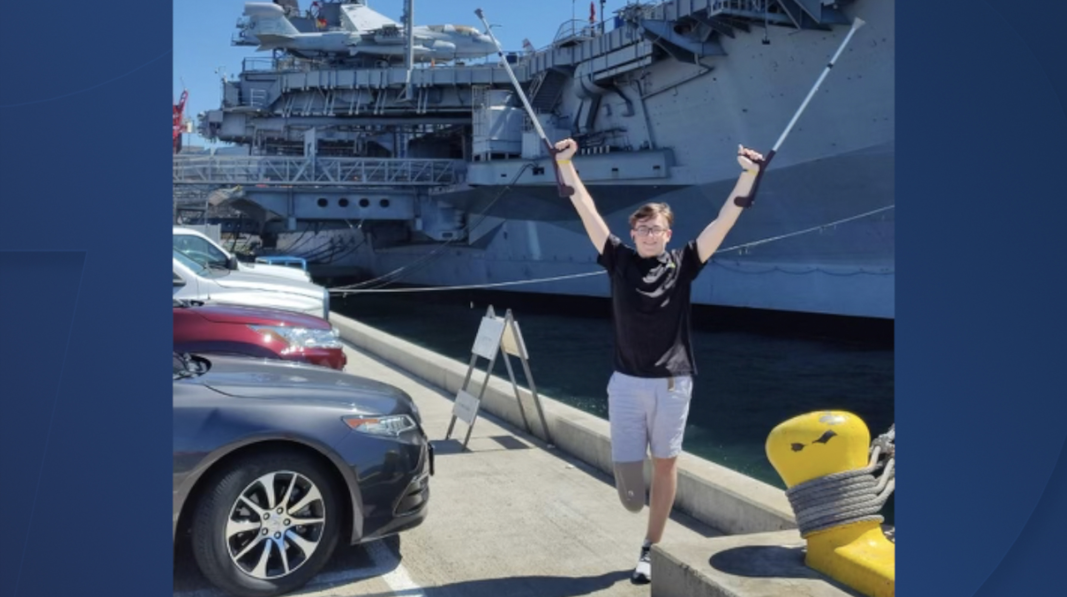 Injured teen who lost leg in Ukraine receives prosthetic care in Mira Mesa
