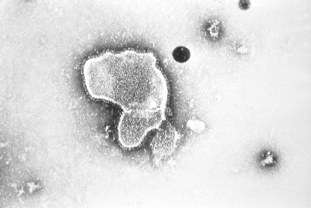 RSV Vaccines