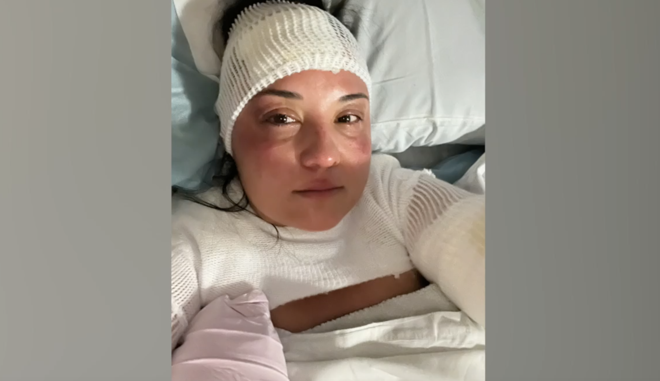 Friends make harrowing escape from North Park fire sparked by E-scooter