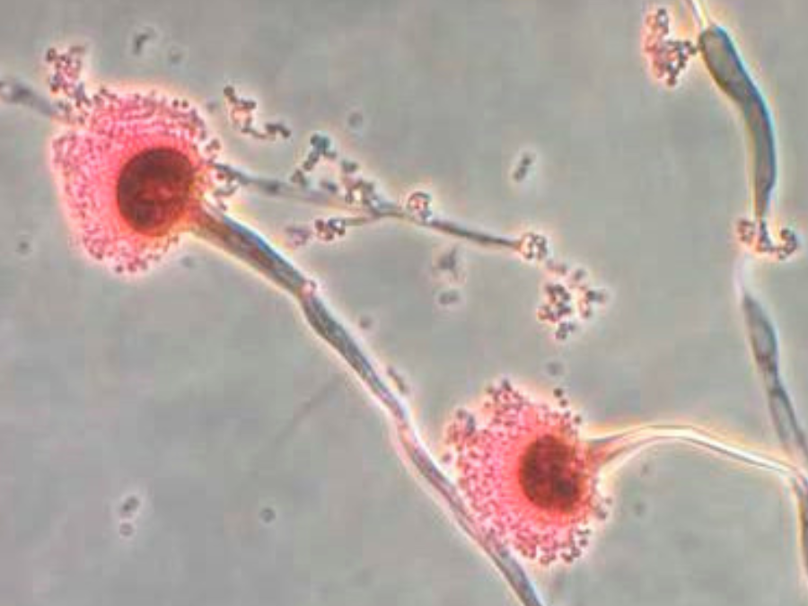 aspergillus_fungi_cnn_reuters.png