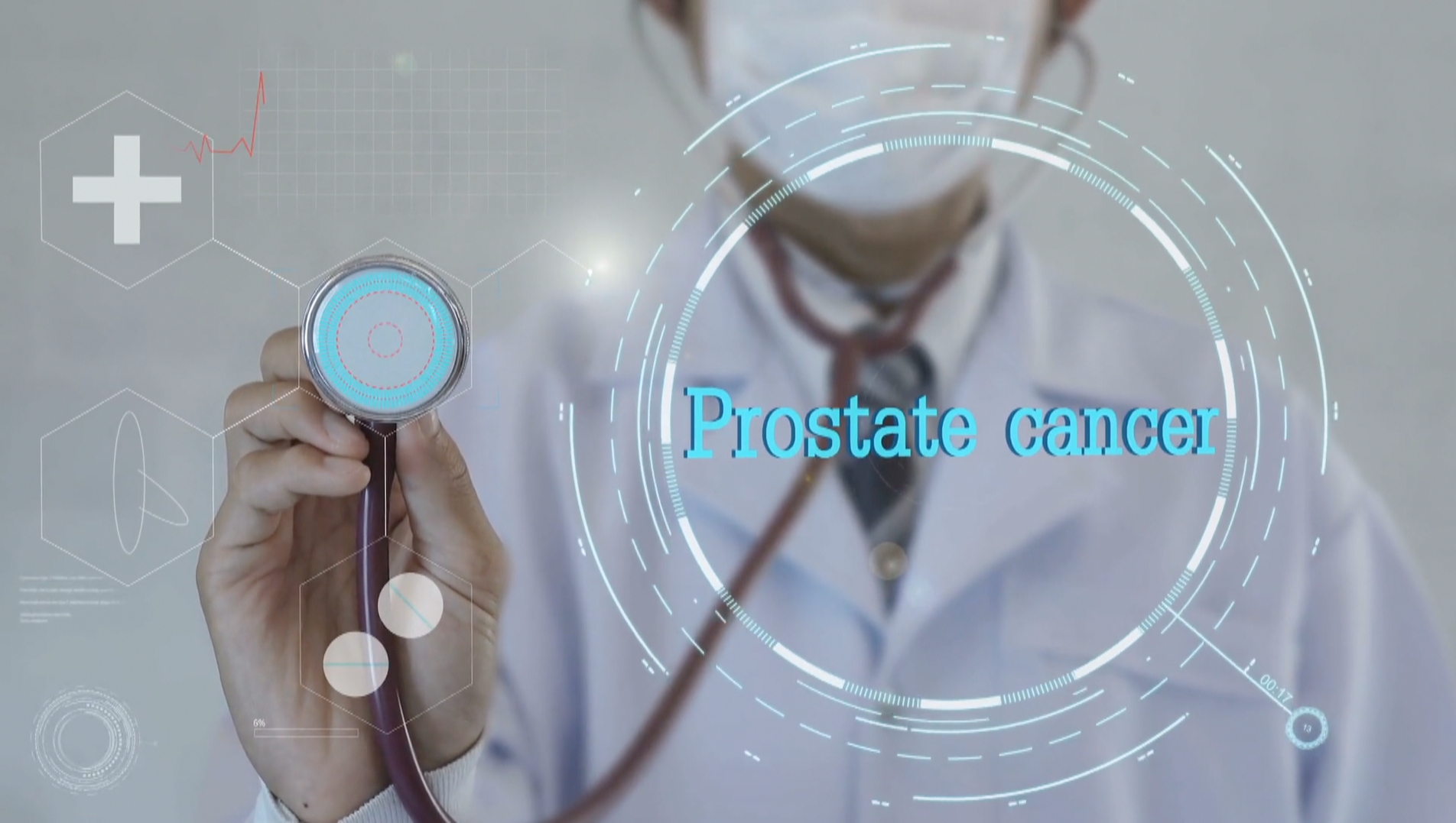 Prostate cancer graphic