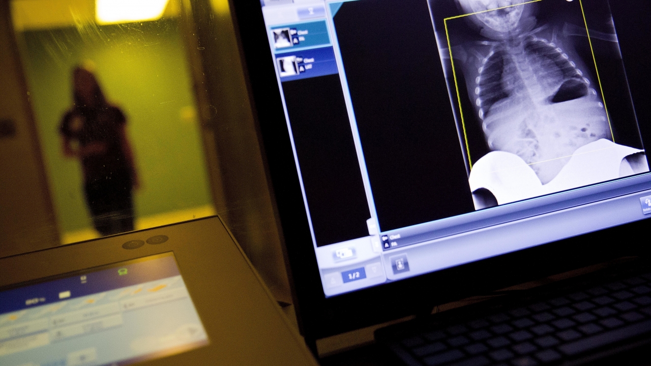 In this Feb. 9, 2018, file photo, a radiology technician looks at a chest X-ray of a child suffering from flu symptoms.